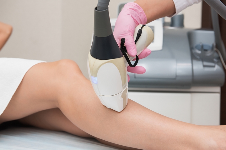 Everything You Should Know About Laser Hair Removal Treatment